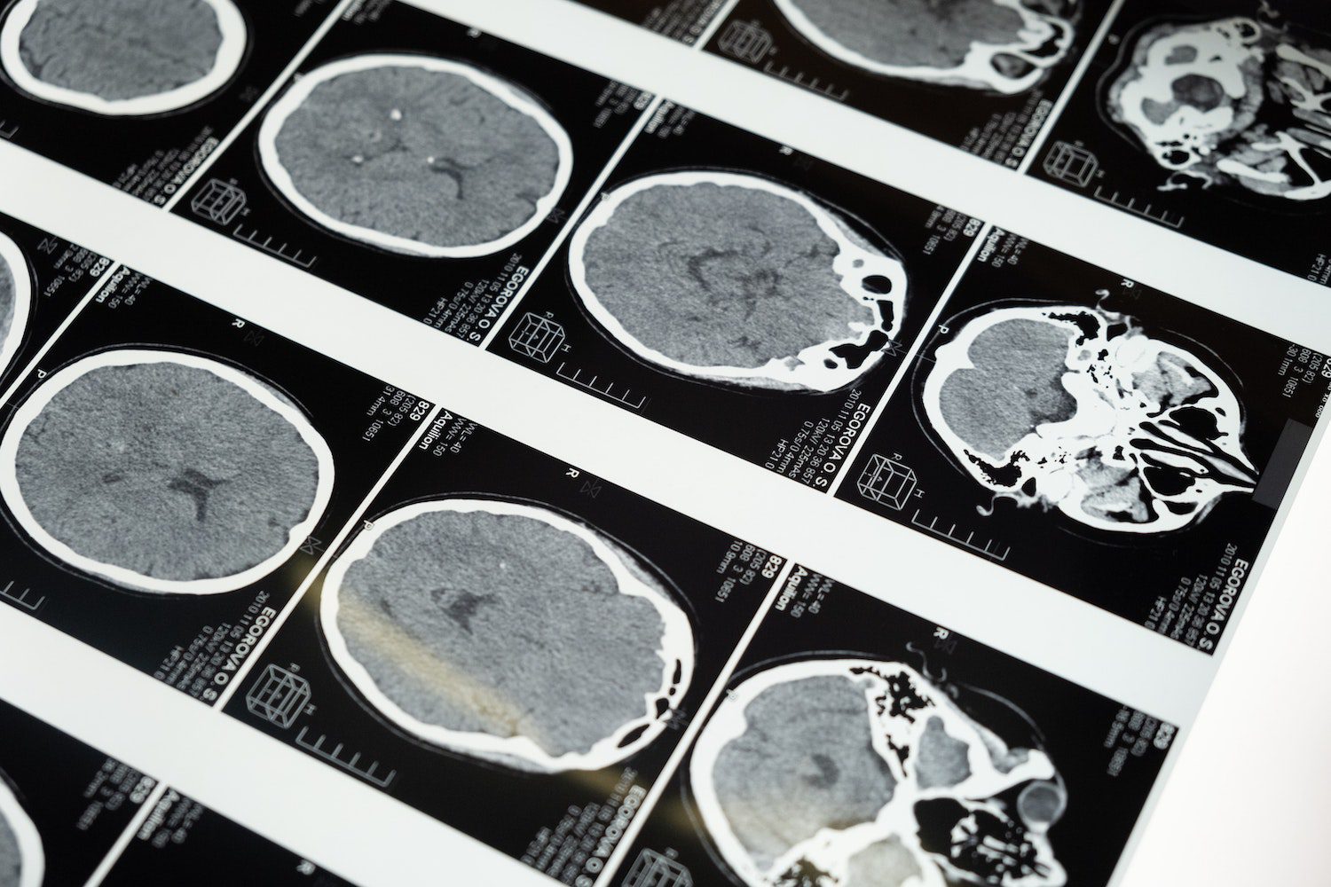 brain-mri-stock
